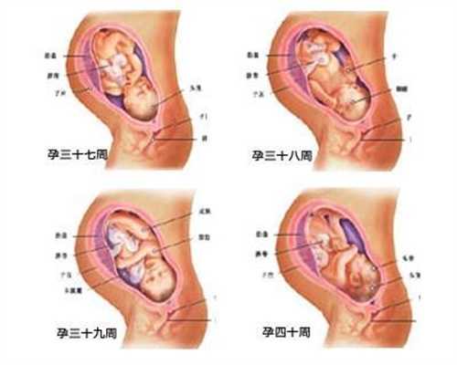 武汉宏博代孕公司需要多少钱：香港孕宝国际武汉招聘：孕妇可以做核磁共振吗